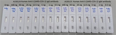 ACE COVID-19 IgG / IgM Dual Detection Kit
