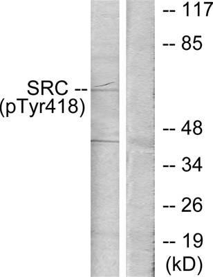 Phospho-c-SRC (Tyr419) Polyclonal Antibody