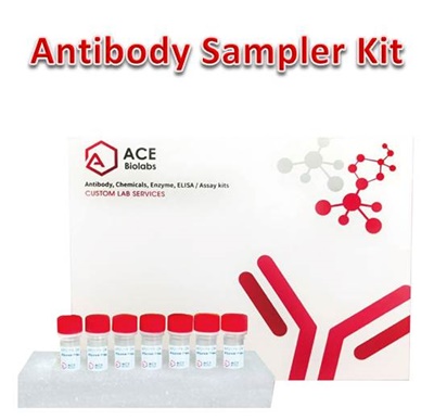Angiogenesis Antibody Sampler Kit