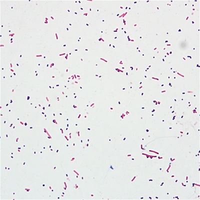 Gram Staining Kit