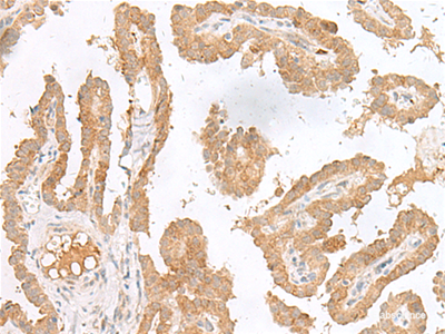 Human CXCL6 Antibody