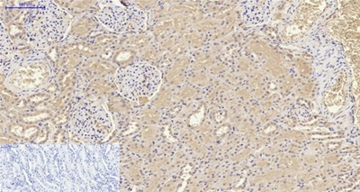 Human IL-8 Polyclonal Antibody