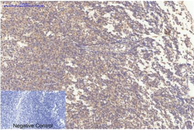 Bax mouse Monoclonal Antibody(6F11)