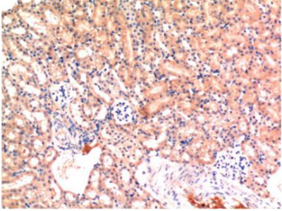 Bax mouse Monoclonal Antibody(6F11)