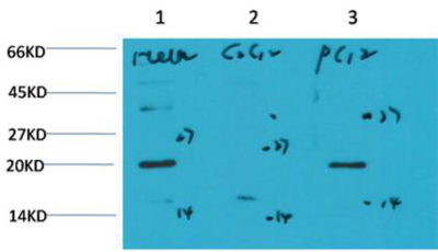 Bax mouse Monoclonal Antibody(6F11)