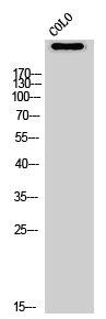 ATR Antibody