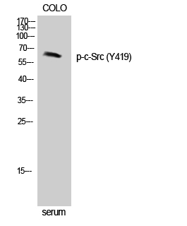 Phospho-c-SRC (Tyr419) Polyclonal Antibody