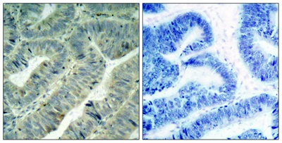 Phospho-c-SRC (Tyr419) Polyclonal Antibody