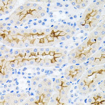 IL17A Polyclonal Antibody