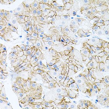 IL17A Polyclonal Antibody