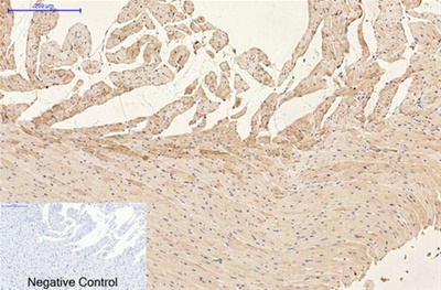 GFAP Monoclonal Antibody(5C8)