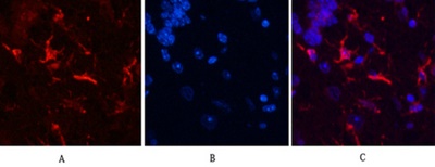 GFAP Monoclonal Antibody(5C8)
