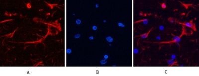 GFAP Monoclonal Antibody(5C8)