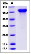 Human PROS1 / Protein S Protein (His Tag)