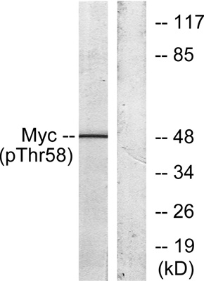 c-Myc (Phospho Thr58) Rabbit pAb