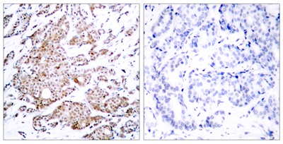 c-Myc (Phospho Thr58) Rabbit pAb