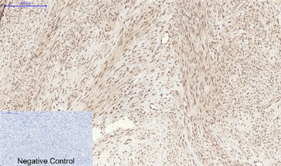 Stat3 (Phospho Ser727) Rabbit pAb