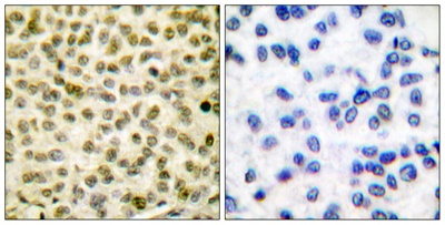 c-Myc (Phospho Ser62) Rabbit pAb