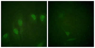 c-Myc (Phospho Ser62) Rabbit pAb