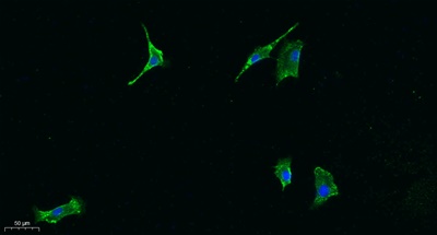 JAK1 (PT0658R) PT® Rabbit mAb