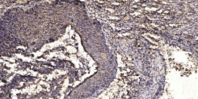 LIFR Rabbit pAb