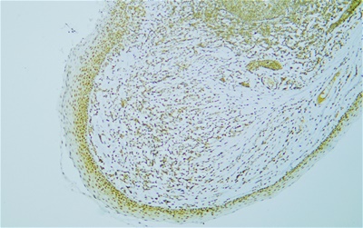 c-MYC (PTR2340) Mouse mAb