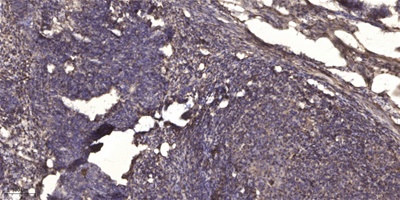 Stat3 (Acetyl Lys87) Rabbit pAb