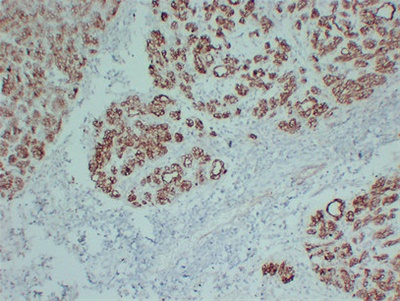 Claudin 4 (PT1925) mouse mAb