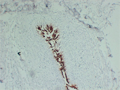 Uroplakin III (ABT-UPK3) mouse mAb