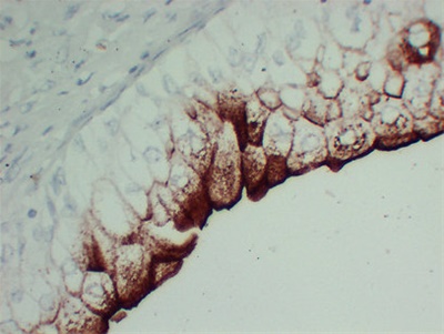 Uroplakin III (ABT-UPK3) mouse mAb