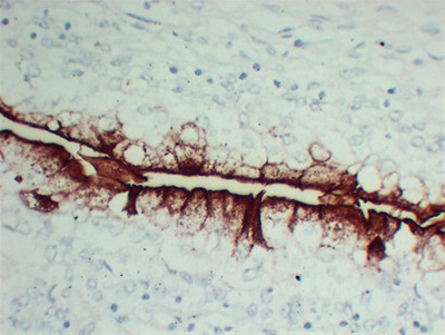 Uroplakin III (ABT-UPK3) mouse mAb