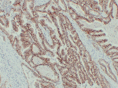 Claudin 7 (PT0731) mouse mAb