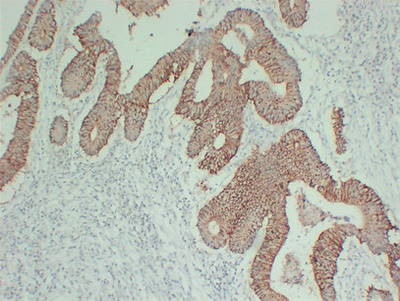 Claudin 7 (PT0731) mouse mAb