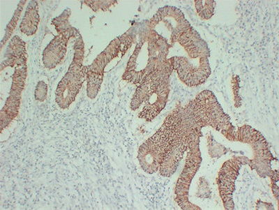 Claudin 7 (PT0731) mouse mAb