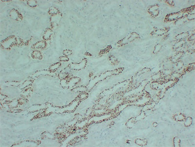 Claudin 7 (PT0731) mouse mAb