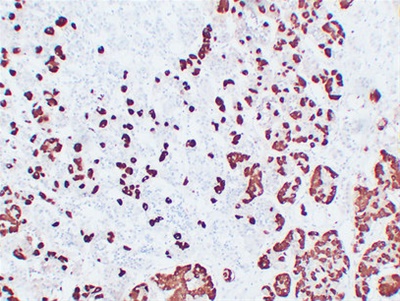 Adrenocorticotropin(ACTH) (ABT-ACTH) mouse mAb