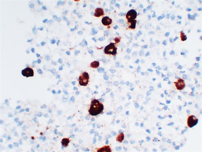 Adrenocorticotropin(ACTH) (ABT-ACTH) mouse mAb