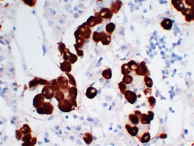 Adrenocorticotropin(ACTH) (ABT-ACTH) mouse mAb
