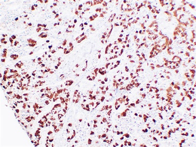 Adrenocorticotropin(ACTH) (ABT-ACTH) mouse mAb