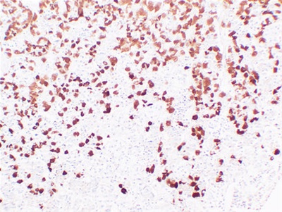 Adrenocorticotropin(ACTH) (ABT-ACTH) mouse mAb