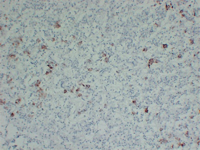 Thyroid-Stimulating Hormone(TSH) (ABT-TSH) mouse mAb