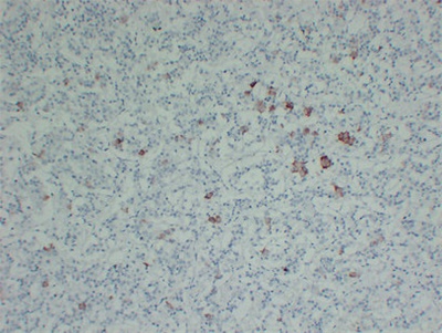 Thyroid-Stimulating Hormone(TSH) (ABT-TSH) mouse mAb