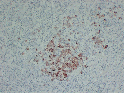 Thyroid-Stimulating Hormone(TSH) (ABT-TSH) mouse mAb