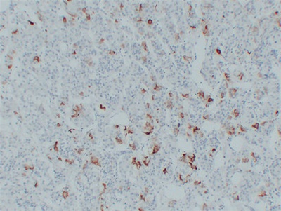 Thyroid-Stimulating Hormone(TSH) (ABT-TSH) mouse mAb