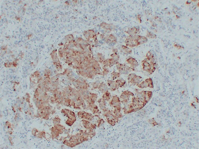 Thyroid-Stimulating Hormone(TSH) (ABT-TSH) mouse mAb