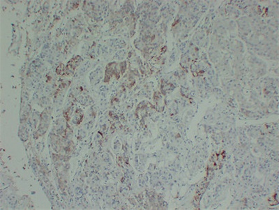 Prolactin (PT0220) mouse mAb