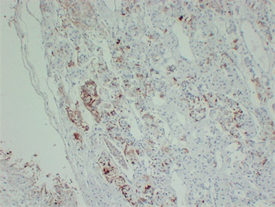 Prolactin (PT0220) mouse mAb