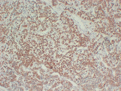 Growth Hormone(GH) (ABT-GH) mouse mAb