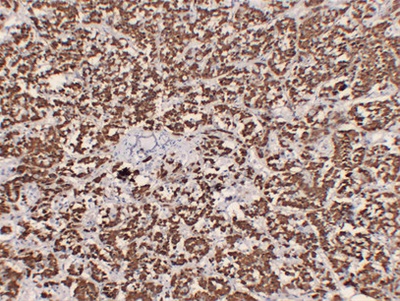 Growth Hormone(GH) (ABT-GH) mouse mAb