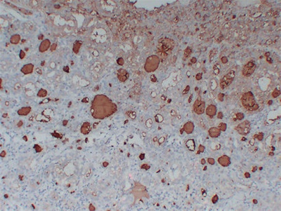 Thyroglobulin (PT2174) mouse mAb